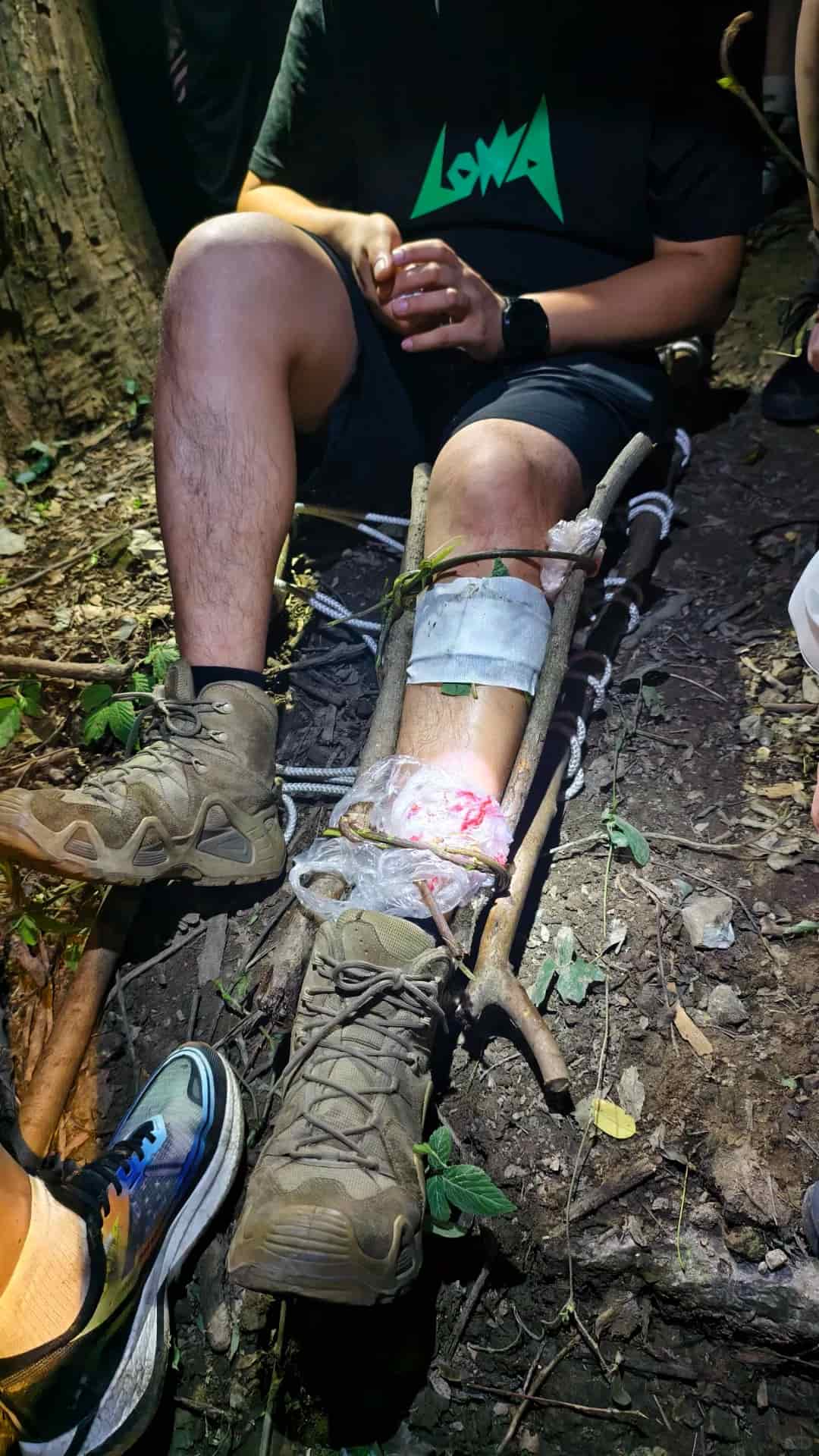 15 Bushcraft First Aid Hacks For Newbie Campers