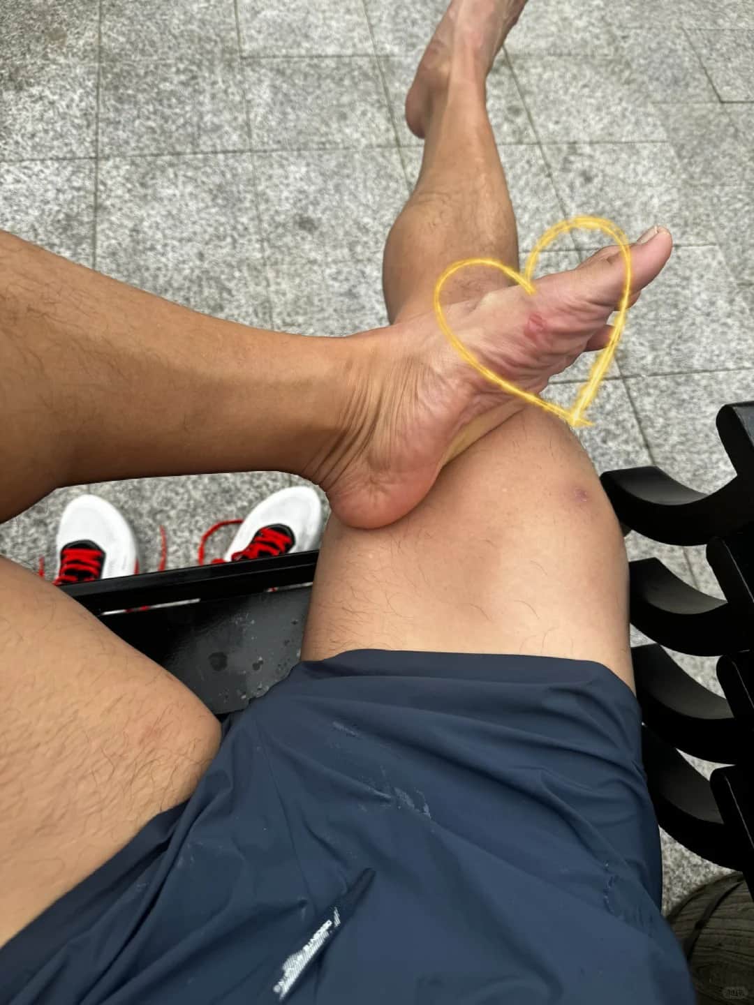 How to Treat A Blister in the Middle of A 5-Mile Hike？