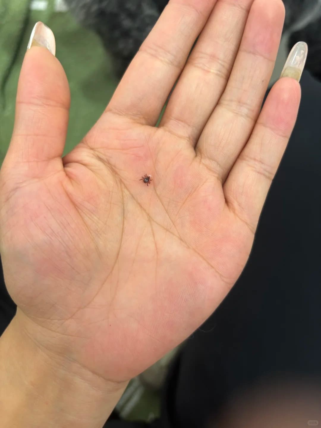 The Tick Check Ritual: Where They Hide And How to Remove Them?